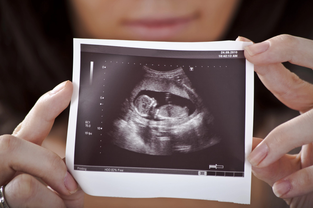 Inteligentna opaska USG dla ciężarnych może ratować życie